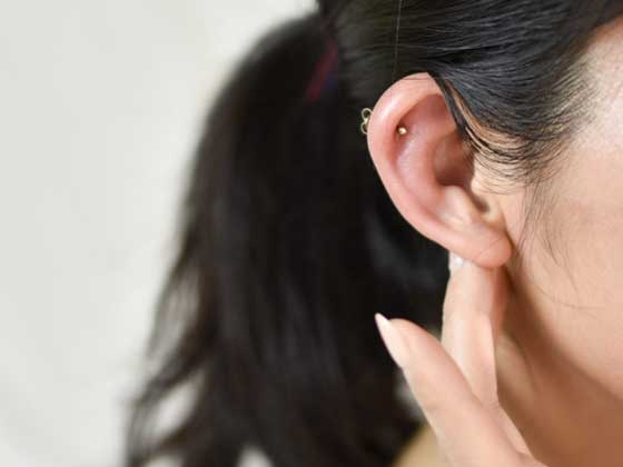 金属アレルギーを発症した女性の耳たぶ